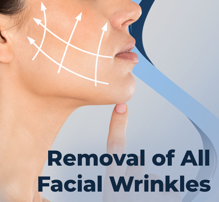 Removal of All Facial Wrinkles